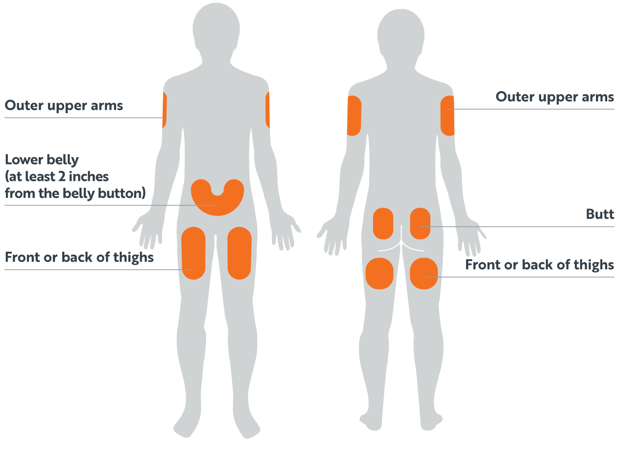 Injection sites labeled on the body